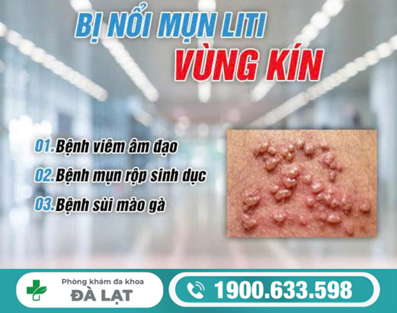 Hình ảnh minh họa